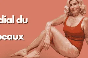 Le 25 juin, célébrons toutes les peaux