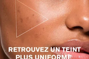 L’été a laissé des taches ? ☀️
